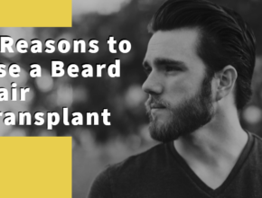 beard hair transplant