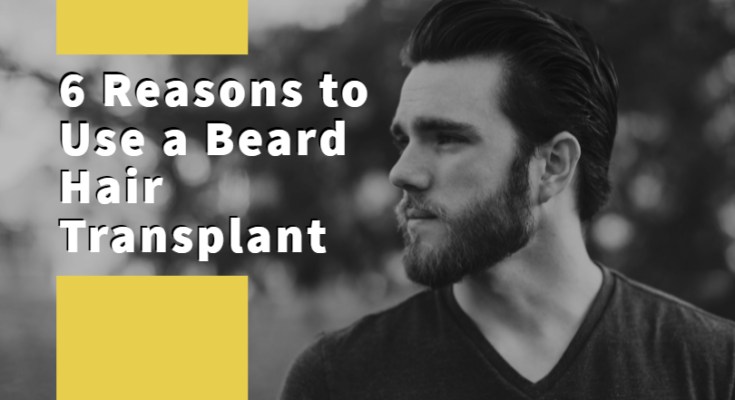 beard hair transplant